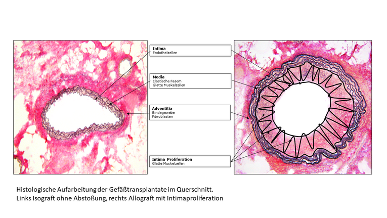 Histologische Aufarbeitung der Gefäßtralsplantate im Querschnitt. Pink Dargestellte Zellen. 